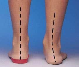 physio adelaide, physio near me, physio open now, physio appt today, physio in my area, physio and corona virus, physio and covid-19, covid-19 and physiotherapy, corona virus and physiotherapy