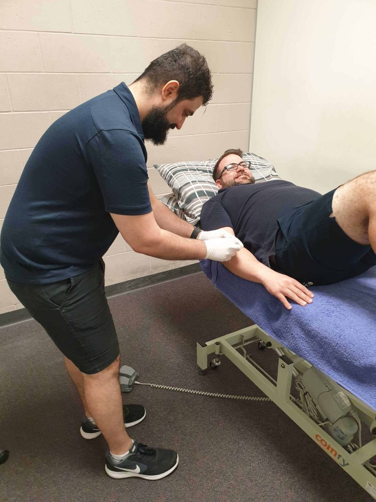 dry-needling-physio