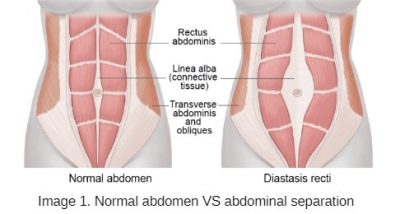 pregnancy physio near me