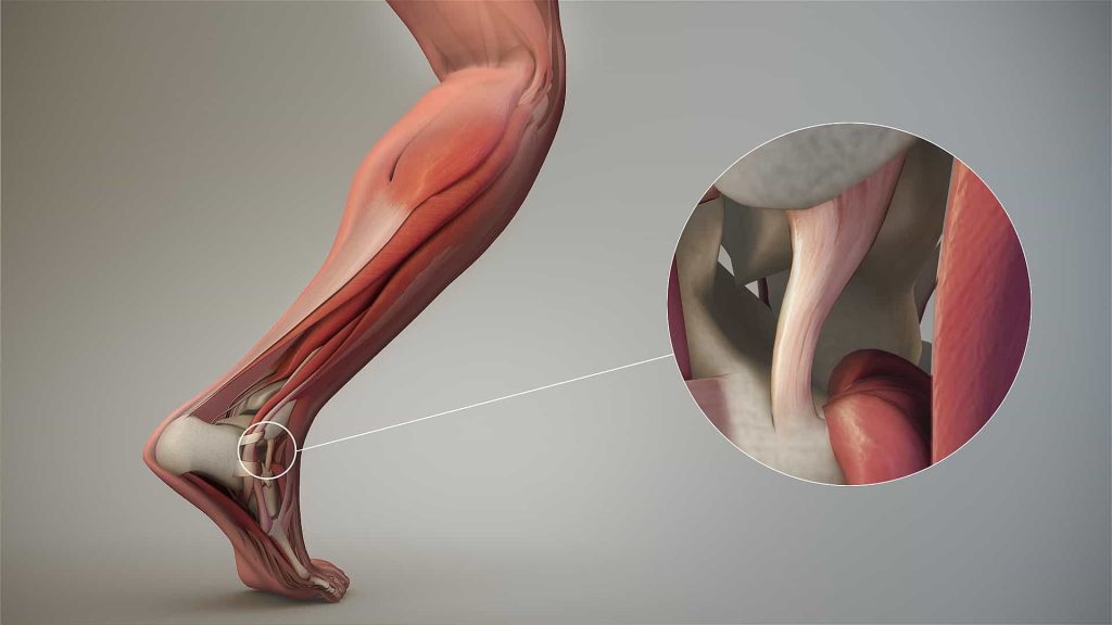Physio Adelaide, Adelaide Physio, Plympton Physio, Physio Plympton, Physiotherapy Plympton, Plympton Physiotherapy, Physio Near Me, Physio Appt Today, Physio Open Now