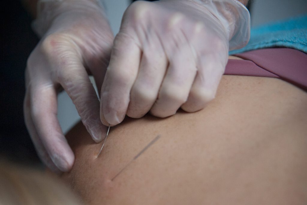 Adelaide dry needling